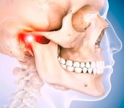 Desenho de um crânio humano focando na articulação temporomandibular
