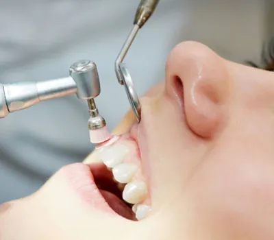 Pessoa branca em um consultório fazendo limpeza dos dentes, profilaxia